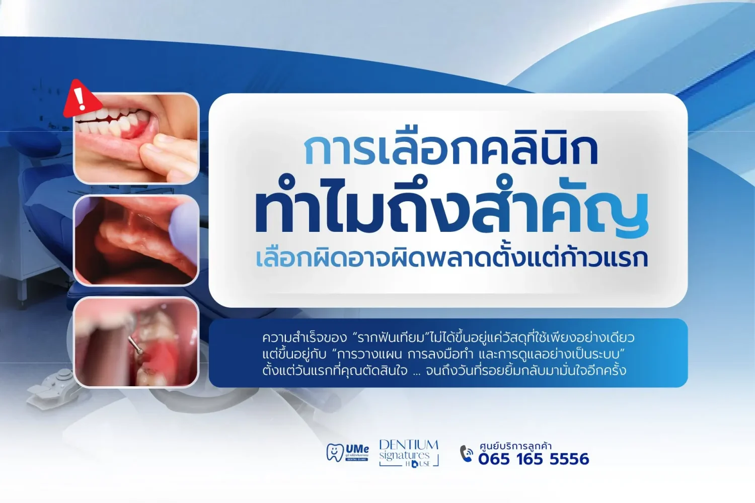 ทำรากฟันเทียม