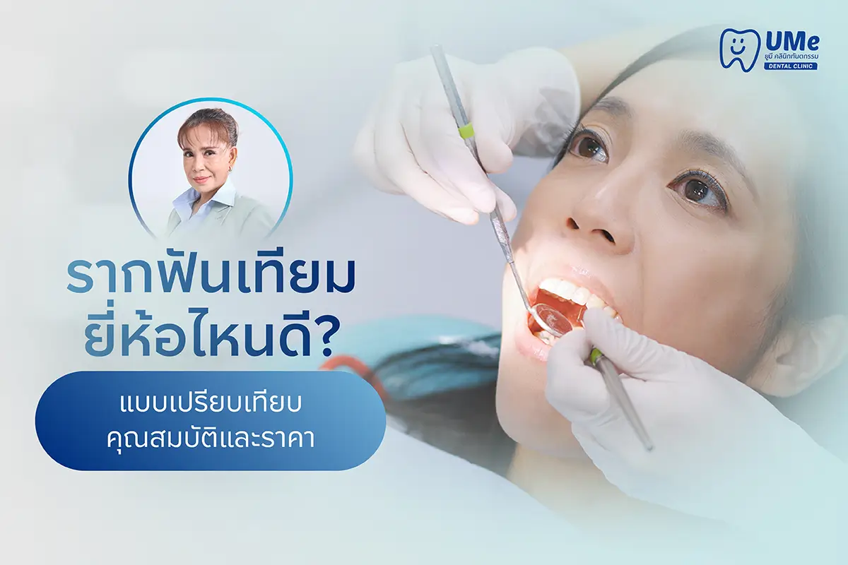 รากฟันเทียม ยี่ห้อไหนดี