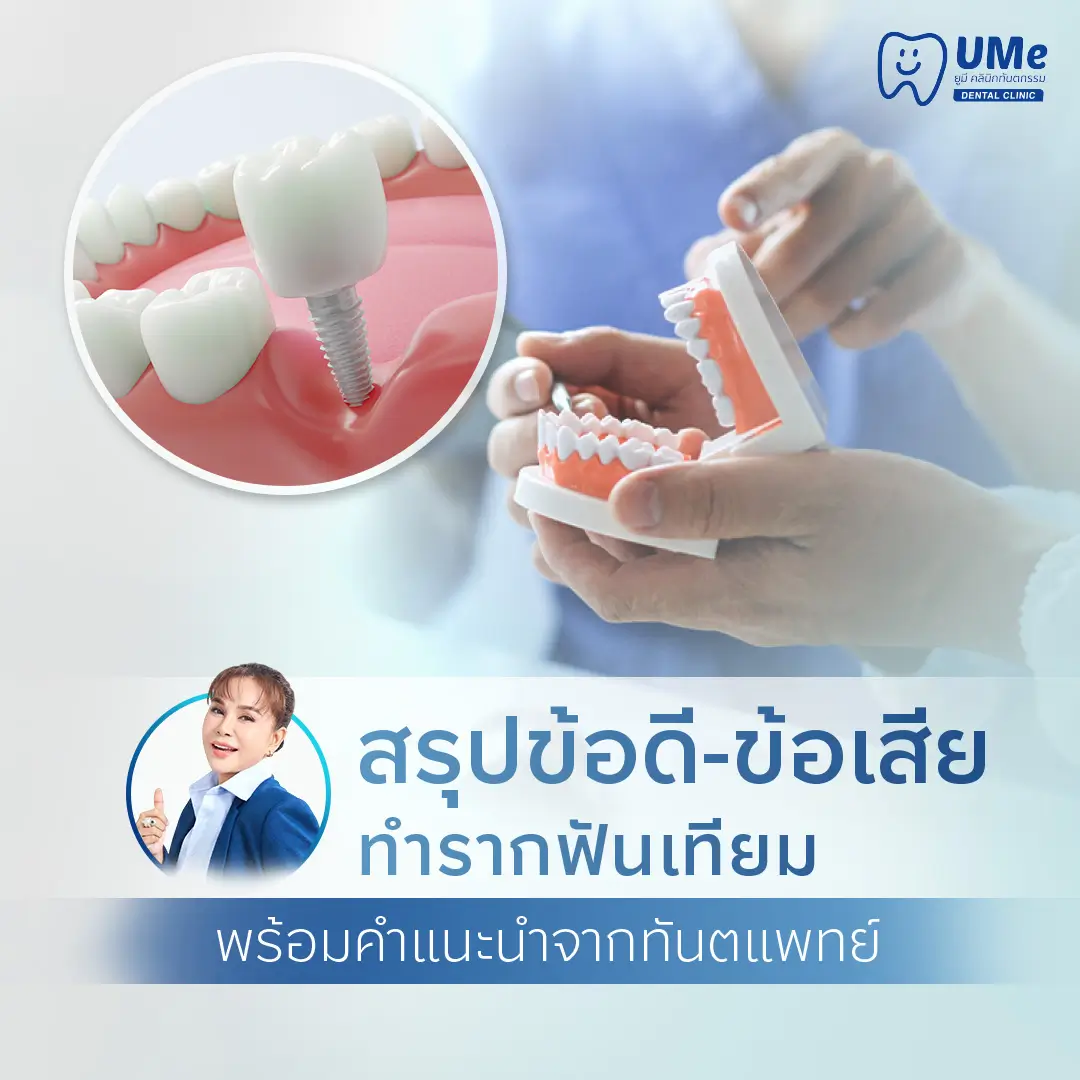 ข้อเสียรากฟันเทียม