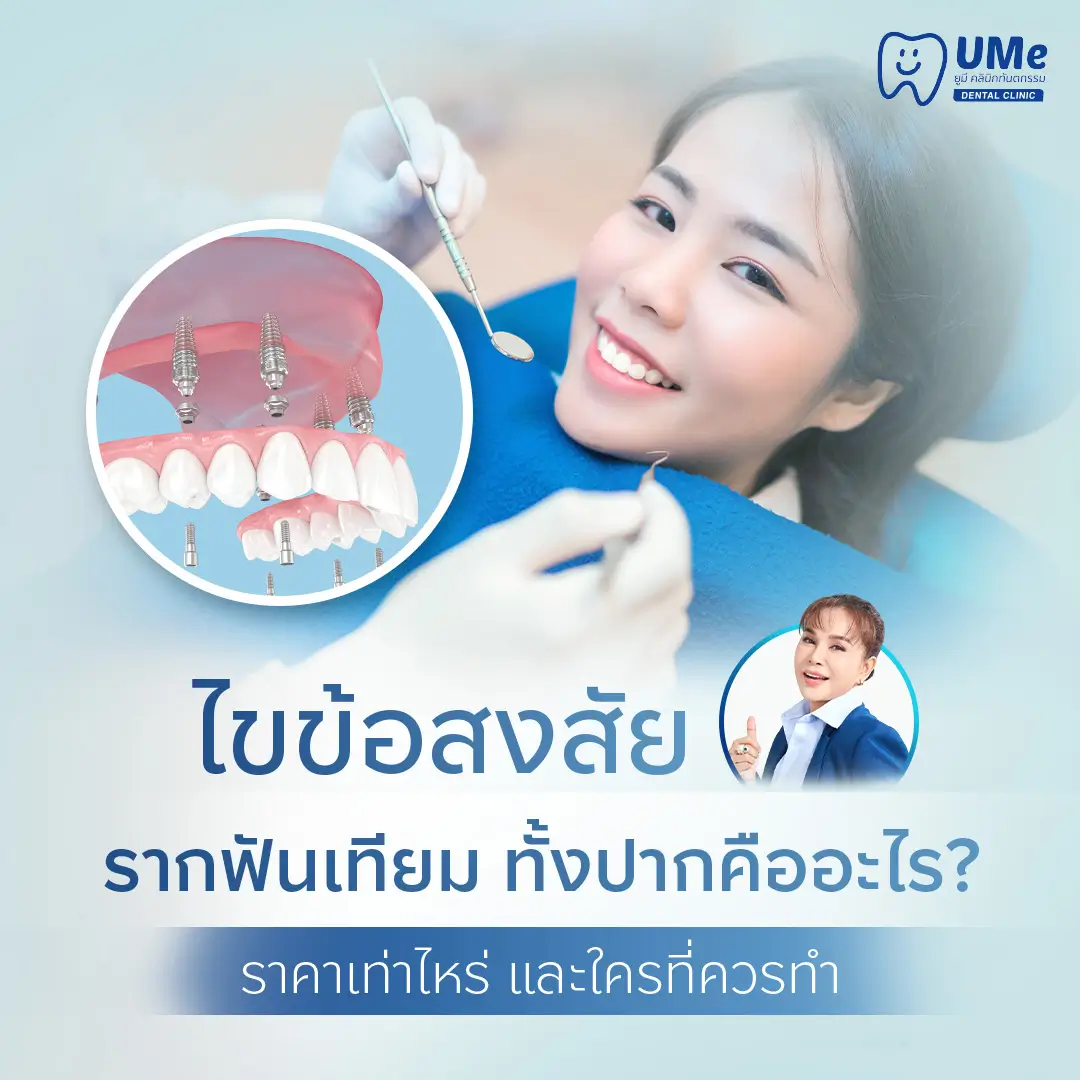 รากฟันเทียมทั้งปาก