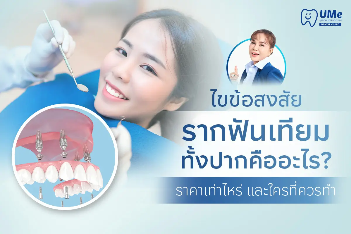 รากฟันเทียมทั้งปาก