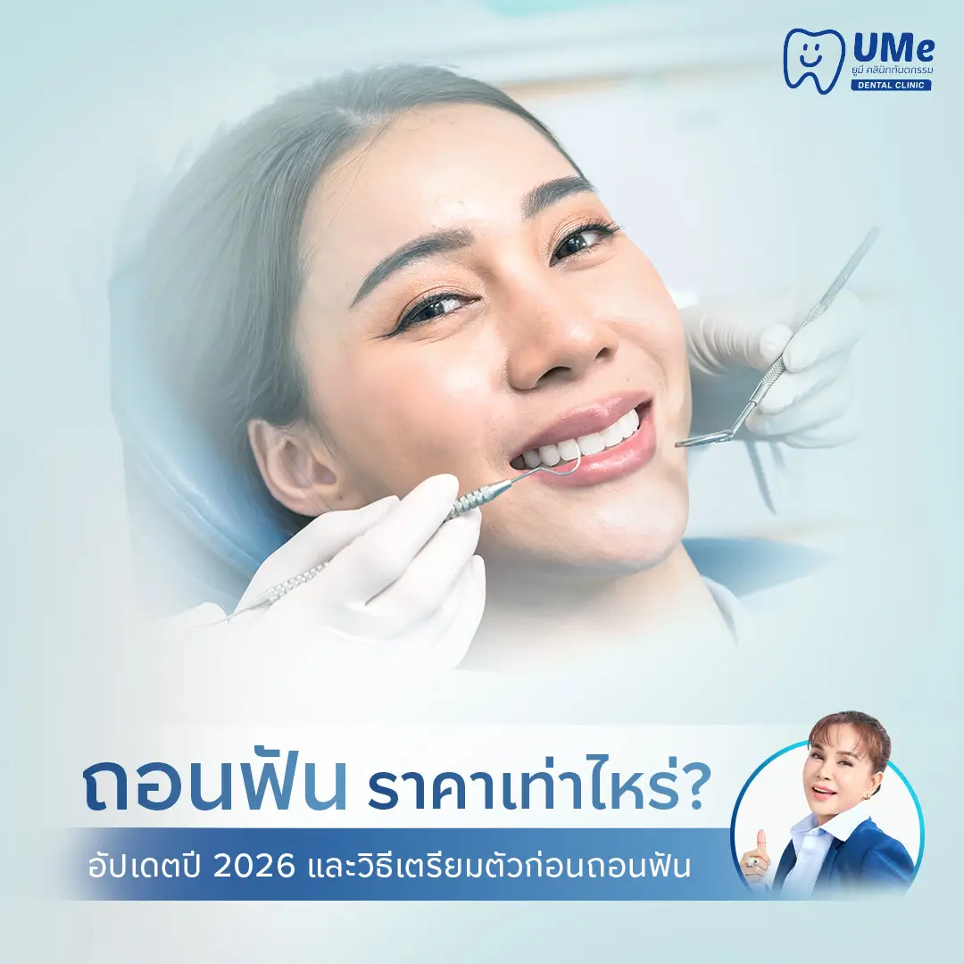 ถอนฟัน ราคา