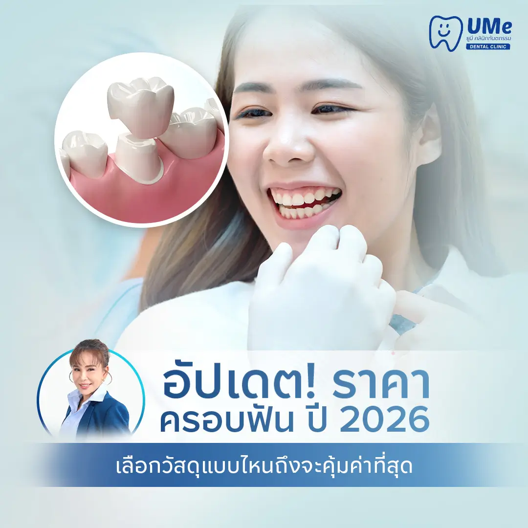 ครอบฟัน ราคา