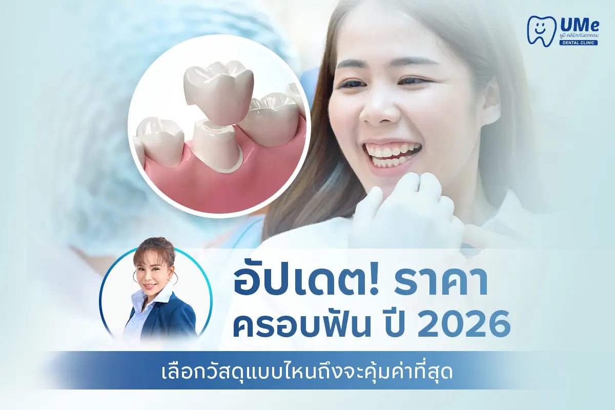 ครอบฟัน ราคา