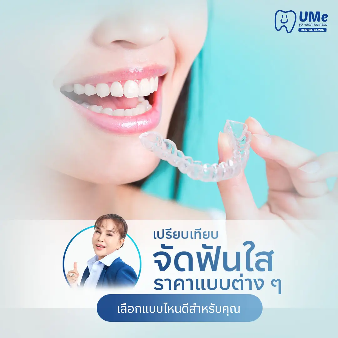 จัดฟันใส