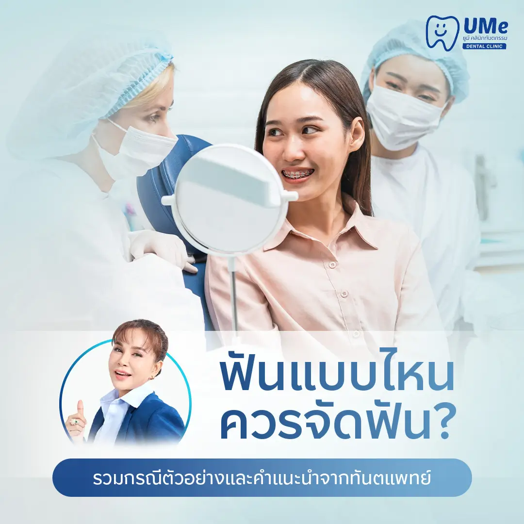 ฟันแบบไหนควรจัดฟัน