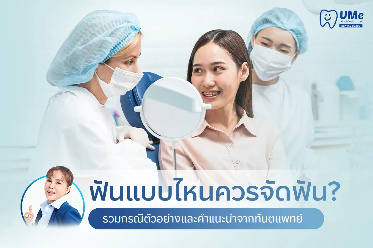 ฟันแบบไหนควรจัดฟัน
