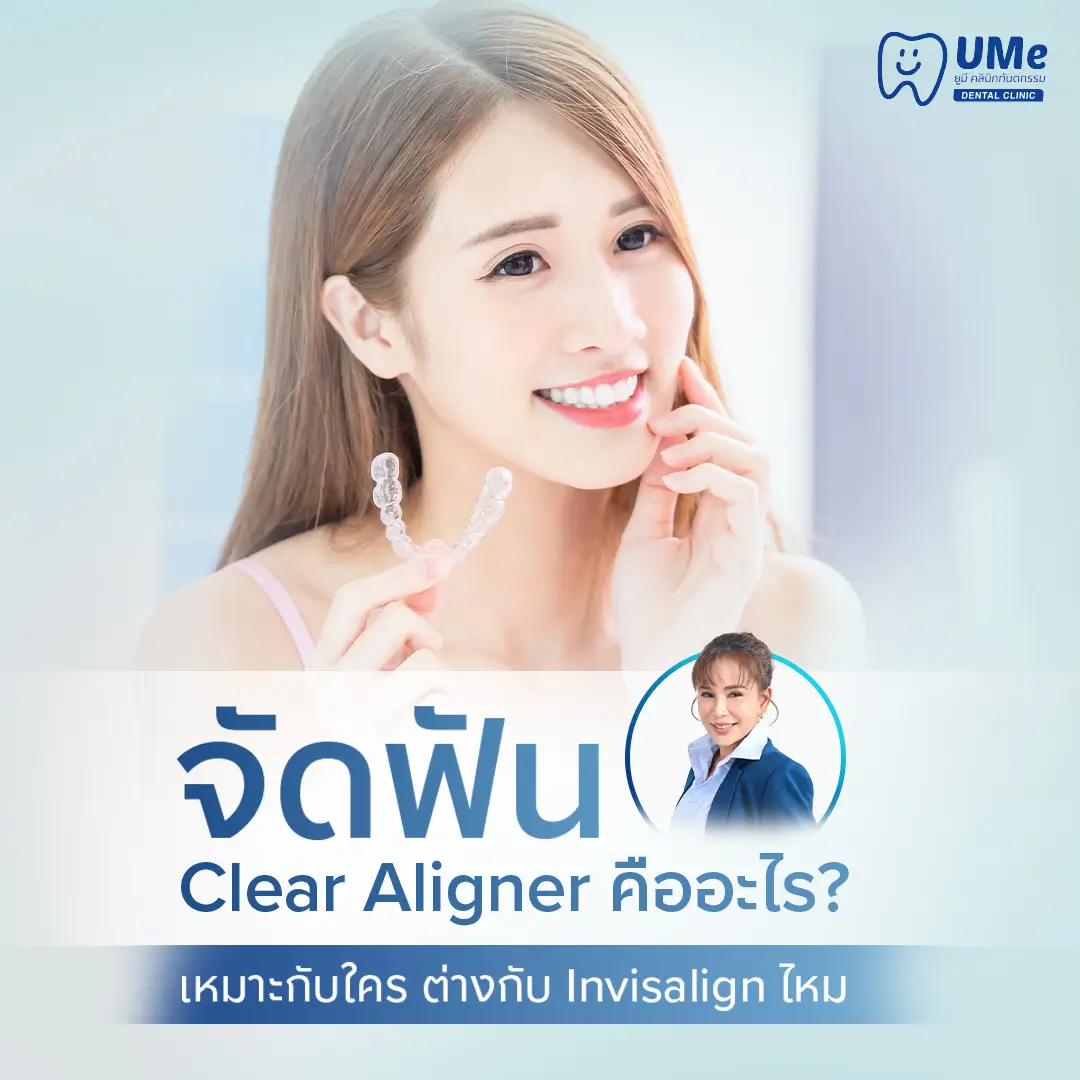 จัดฟัน Clear Aligner