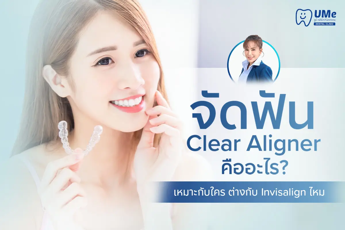 จัดฟัน Clear Aligner