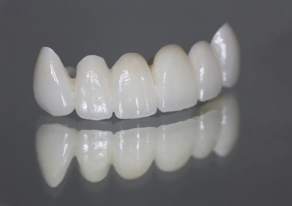 All-Ceramic Crown