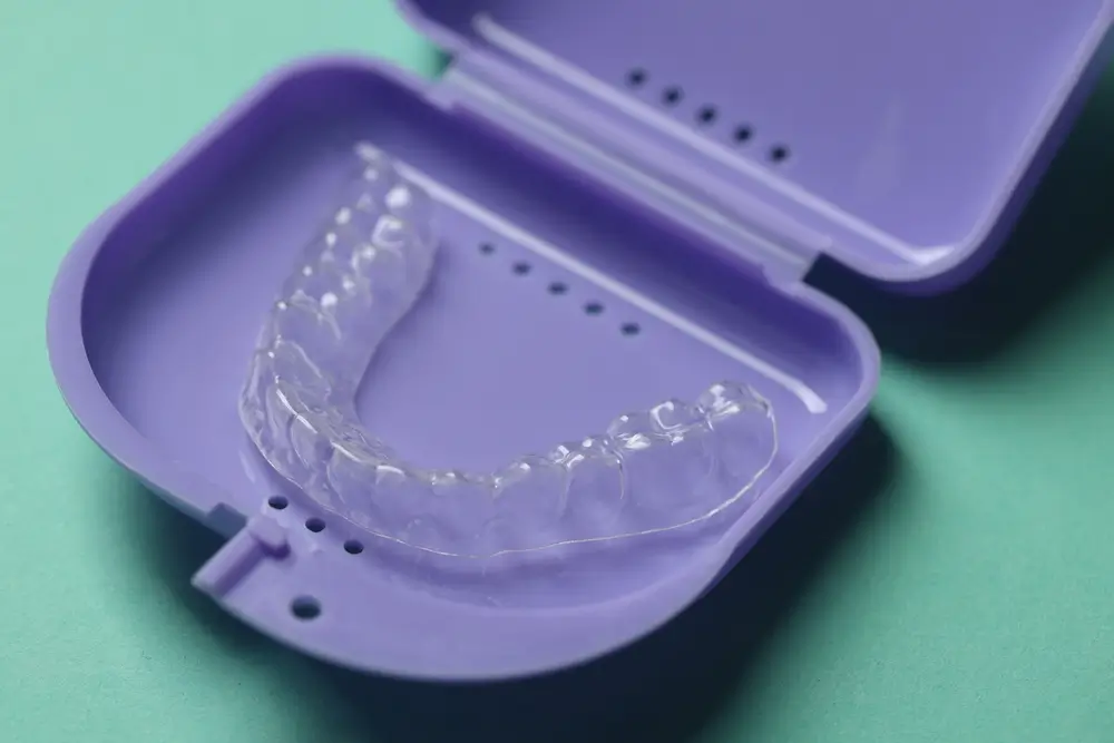 จัดฟัน Clear Aligner ราคา
