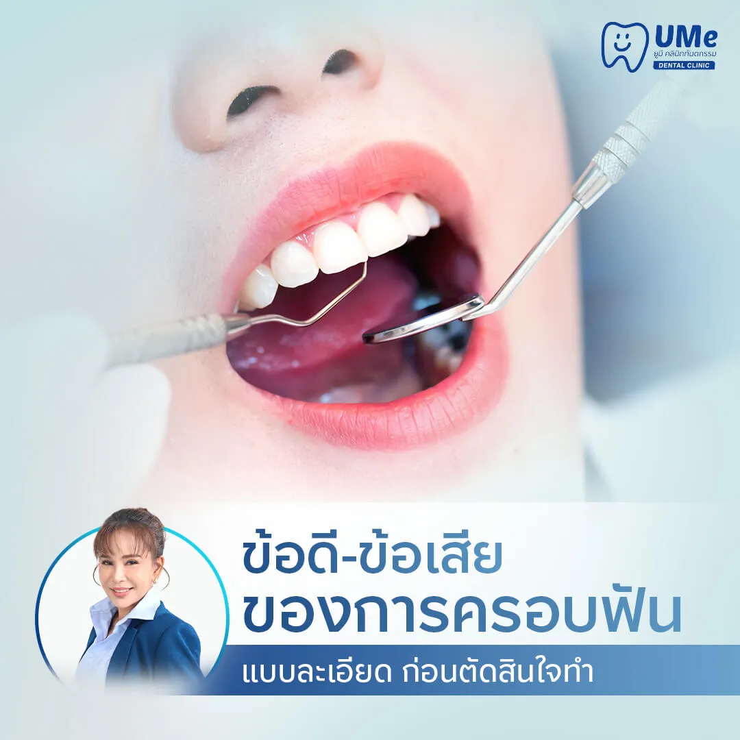 ข้อเสียของการครอบฟัน