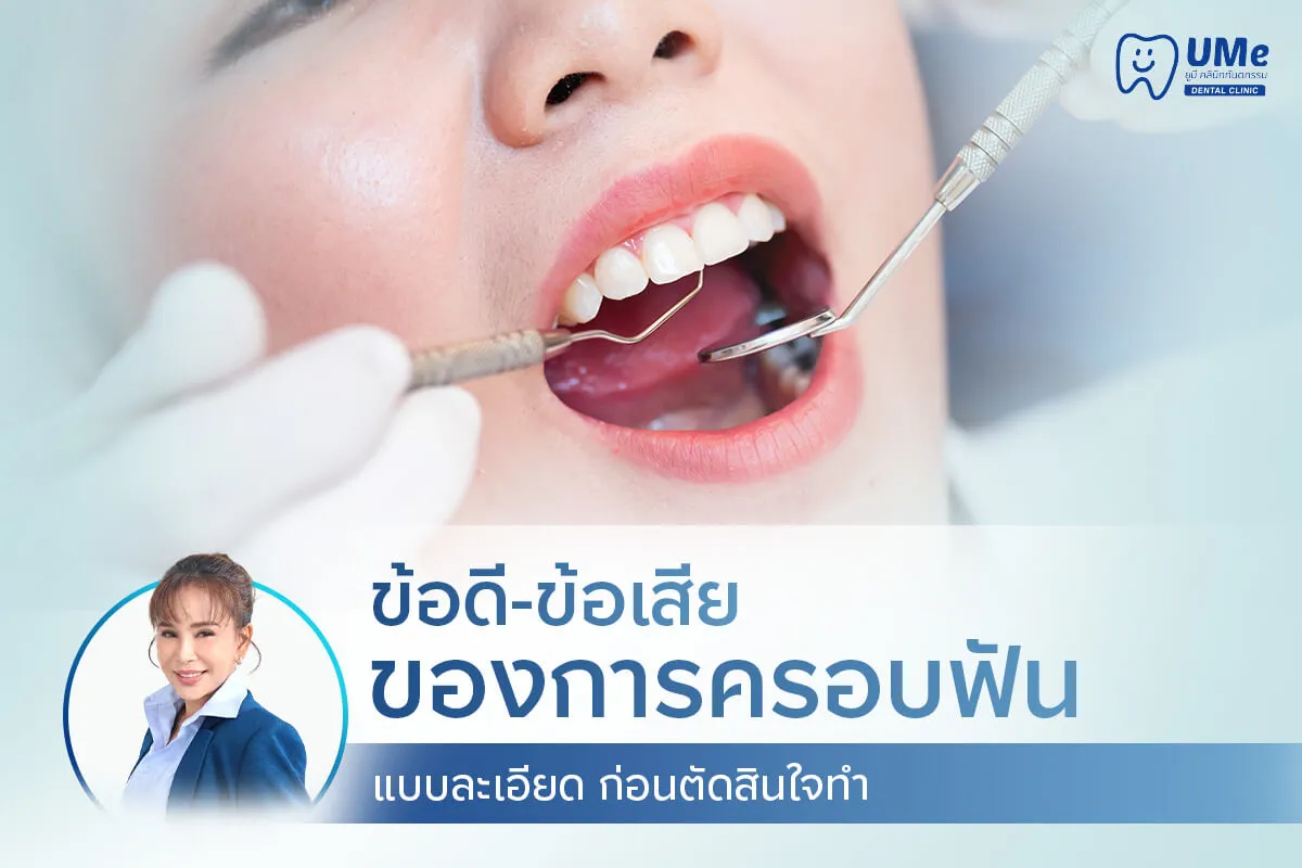 ข้อเสียของการครอบฟัน