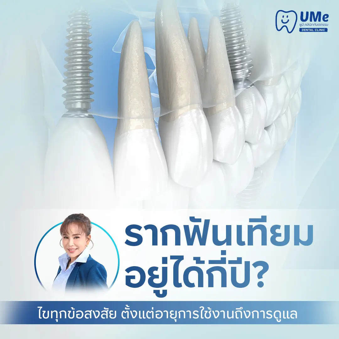 รากฟันเทียมอยู่ได้กี่ปี