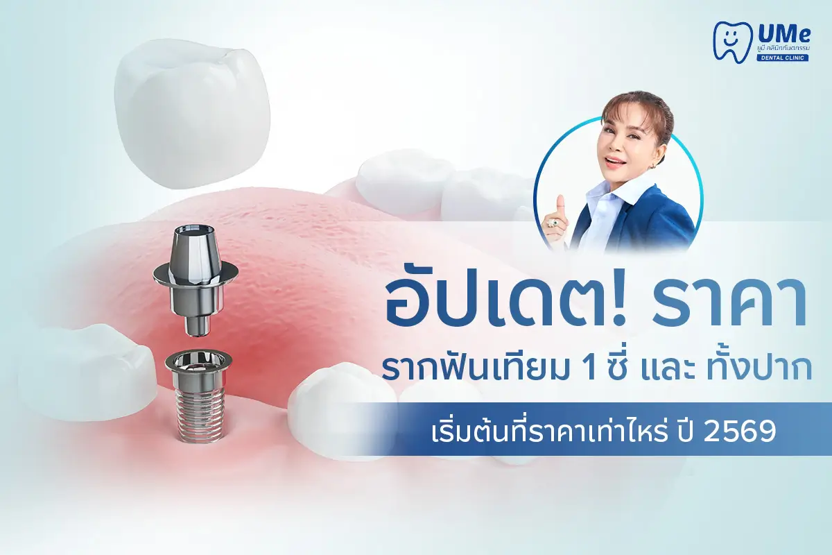 ราคารากฟันเทียม1ซี่