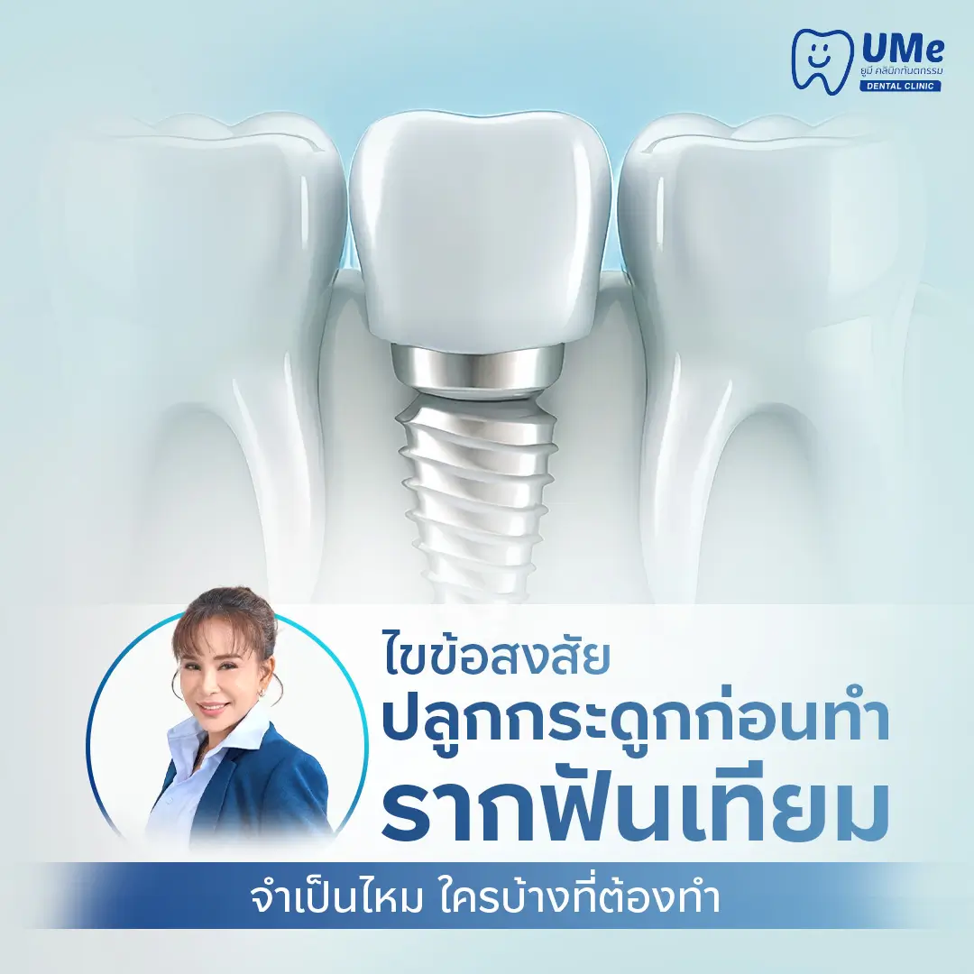 ปลูกกระดูก รากฟันเทียม