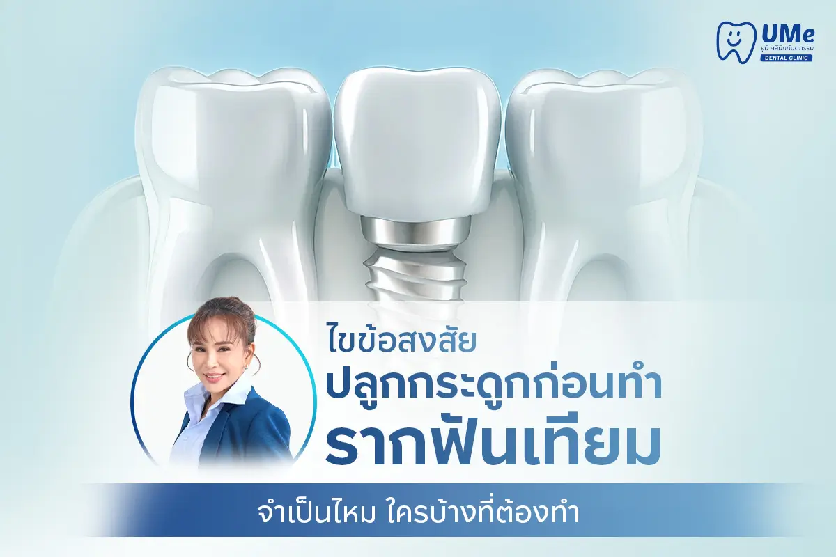 ปลูกกระดูก รากฟันเทียม