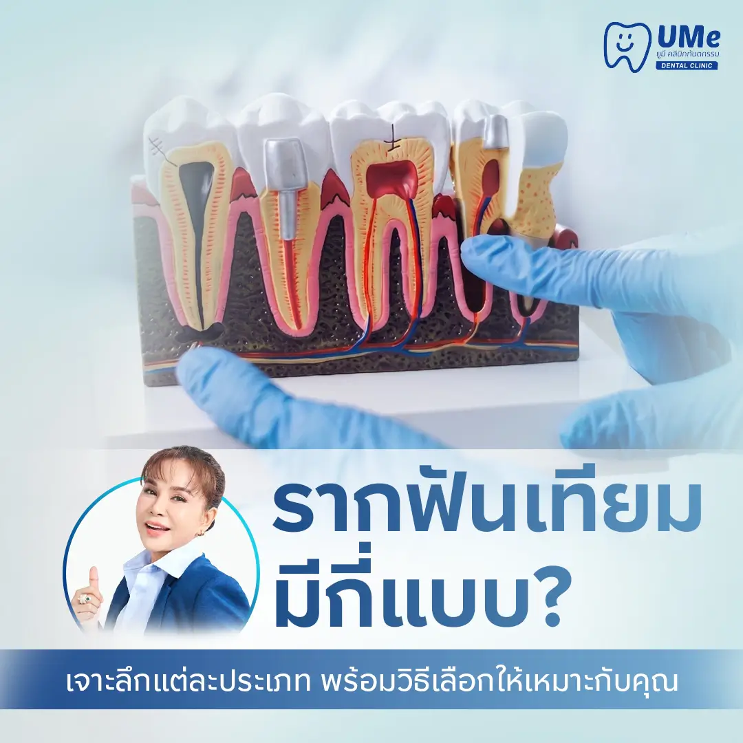 รากฟันเทียม มีกี่แบบ