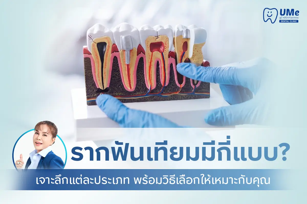 รากฟันเทียม มีกี่แบบ