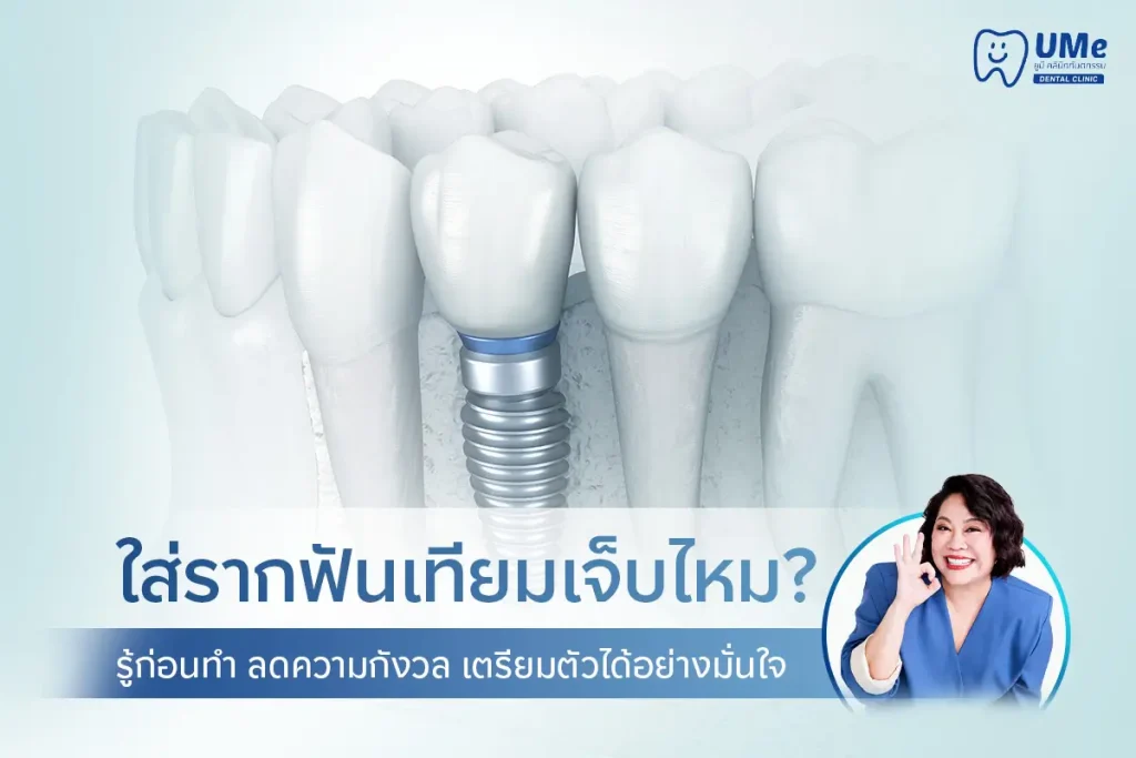 ใส่รากฟันเทียมเจ็บไหม