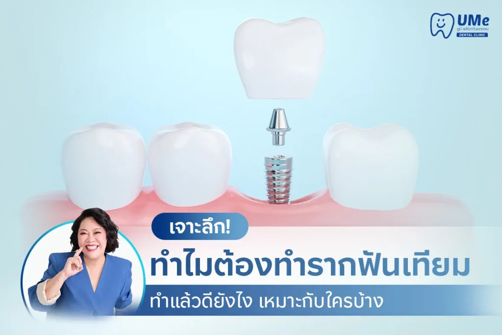 ทำไมต้องทำรากฟันเทียม
